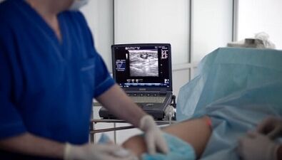 Tratamento cirúrxico de varices